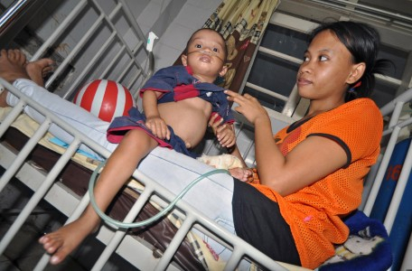 7 Anak Hutumury Ambon Menderita Gizi Buruk