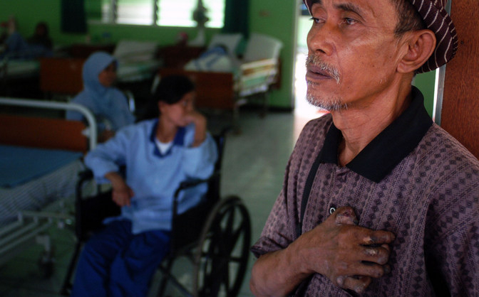 Pengetahuan Lemah, Penderita Kusta Bertambah