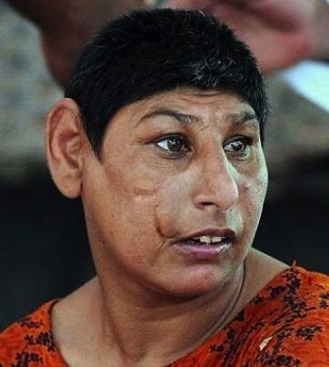 The Plight of the Rat Children in Pakistan
