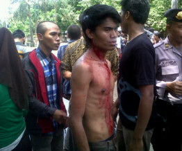 Unjukrasa di Bima Berakhir Bentrok, 5 Demonstran Luka Parah
