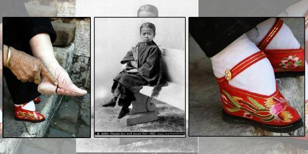 Supaya Cantik, Perempuan Cina Ikat Kaki