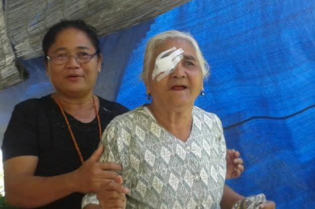 Yayasan Belanda Bantu Operasi Katarak Gratis di Sumba Timur