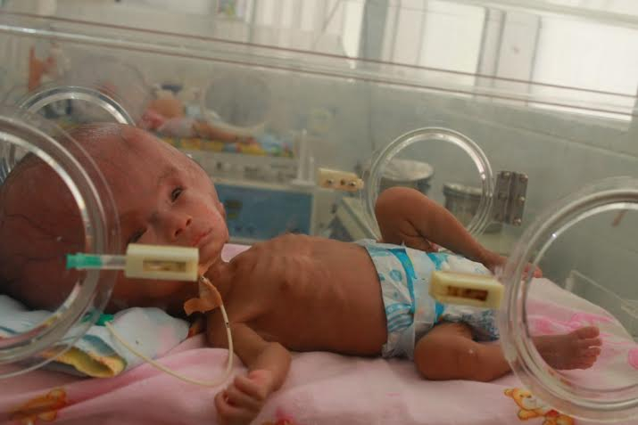 Tolong, Bayi Hidrosefalus Asal Waingapu Butuh Bantuan