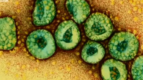 Antisipasi Virus MERS, Pemerintah Pasang Detektor