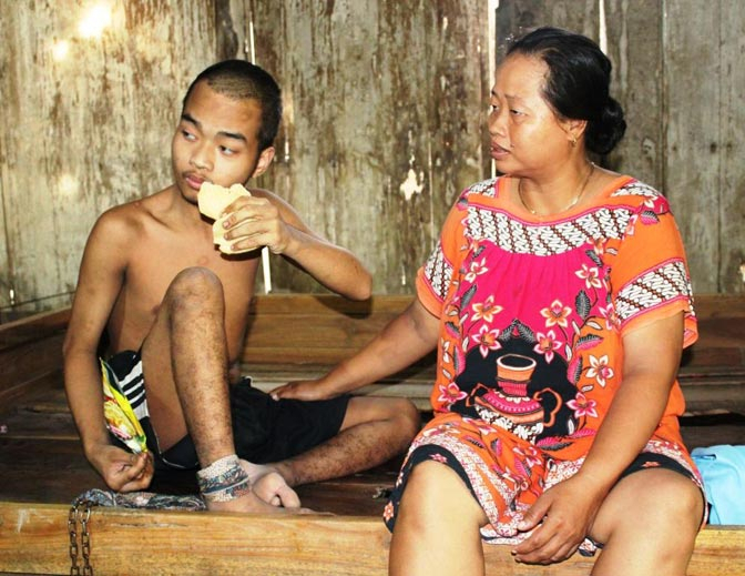 Sering Mengamuk, Remaja Ini Terpaksa Dirantai