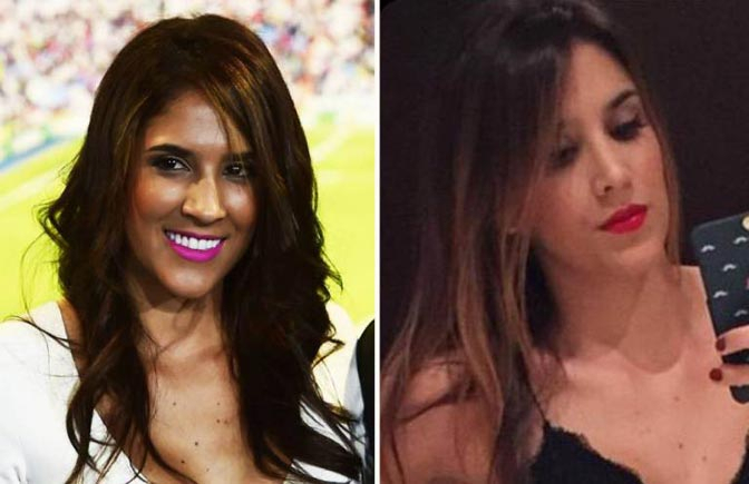 Dibilang Jelek, Istri Pemain Madrid Operasi Plastik