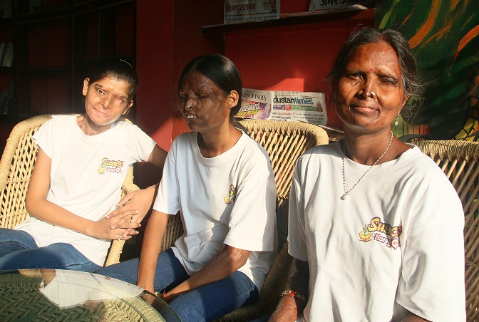 'Sheroes' Cafe: Where Acid Survivors don't Need to Hide