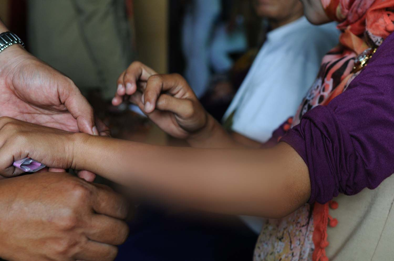 Tantangan Penanggulangan Kusta di tengah Pandemi Covid-19