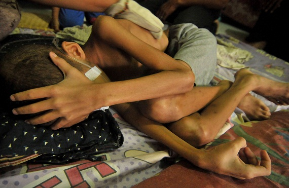Tekan Gizi Buruk, Dinkes Malang Kenalkan Manfaat Daun Kelor