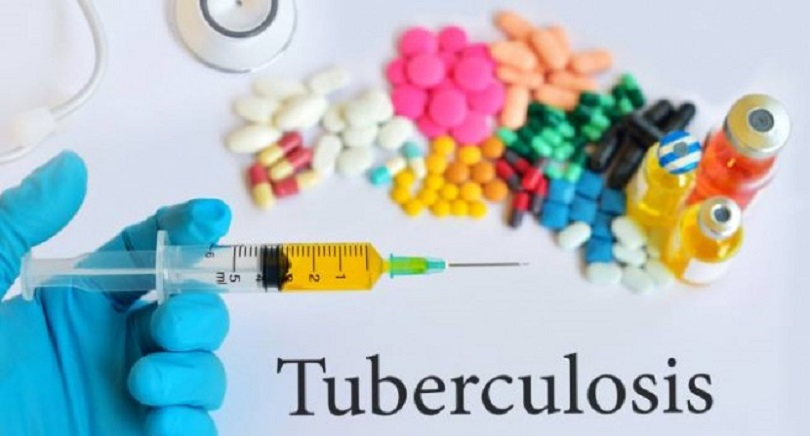 Kemenkes Temukan 860 Ribu Kasus Tuberculosis