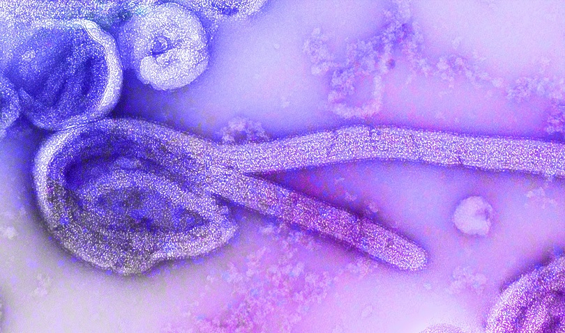 Kemenkes: Tak Perlu Khawatir Wabah Virus Marburg