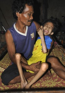 KLB Gizi Buruk di Asmat, Mendagri Minta Daerah Bertindak