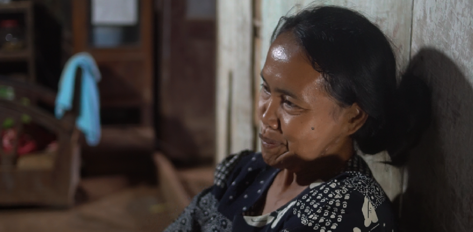 Ngatini, pasien yang dibantu Sedekah Rombongan. Ia mengidap tumor di dagu.