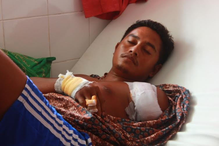 Sempat Bergumul dengan Buaya, Lengan Pemuda Ini Putus 