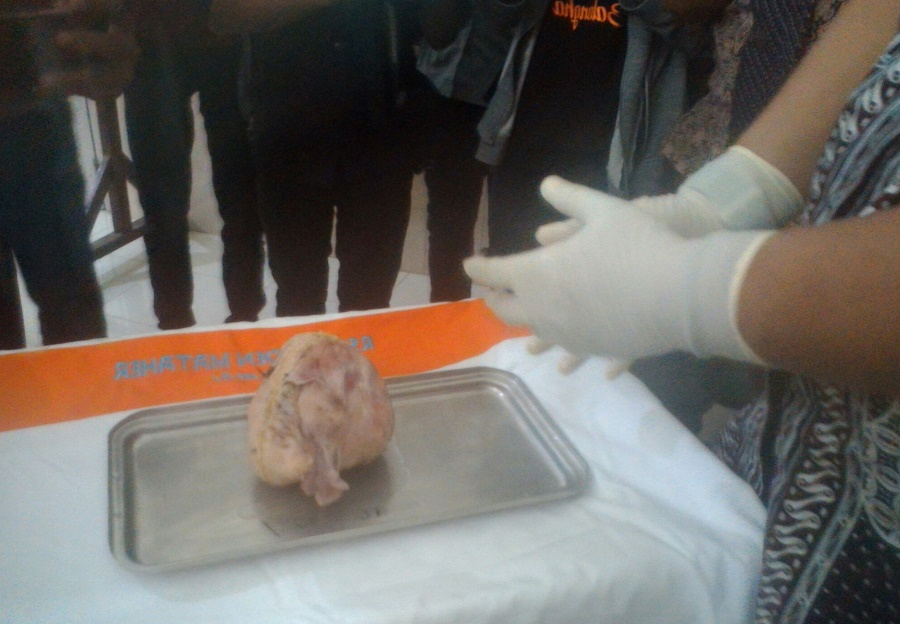 37 Tahun di Dalam Perut, Bayi di Jambi ini Jadi Mumi