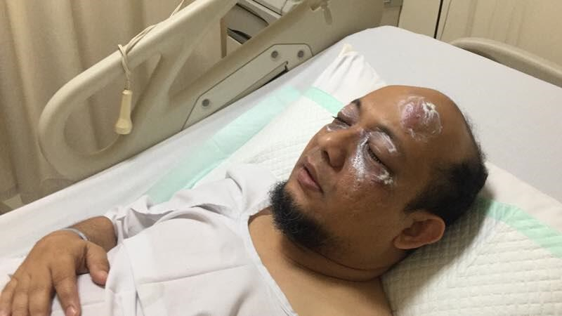 Hampir Sembilan Bulan, 100 CCTV Diperiksa, Pelaku Penyerang Novel Baswedan Masih Misteri