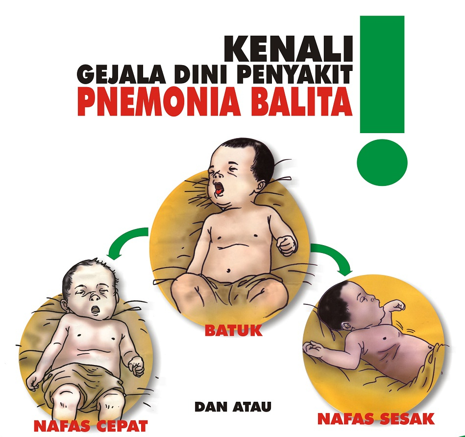 Kemenkes: Pneumonia Jadi Penyebab Utama Kematian Balita